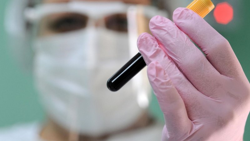 В Уфе запустили производство препаратов для свертываемости крови